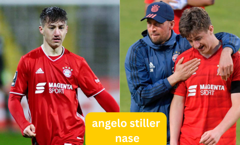 angelo stiller nase